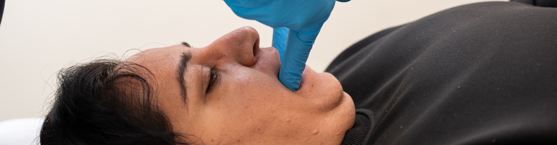 TMJ-dysfunction-Haney-Physiotherapy-Maple-Ridge-BC