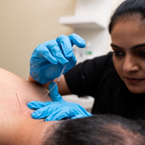 acupuncture-Haney-Physiotherapy-Maple-Ridge-BC